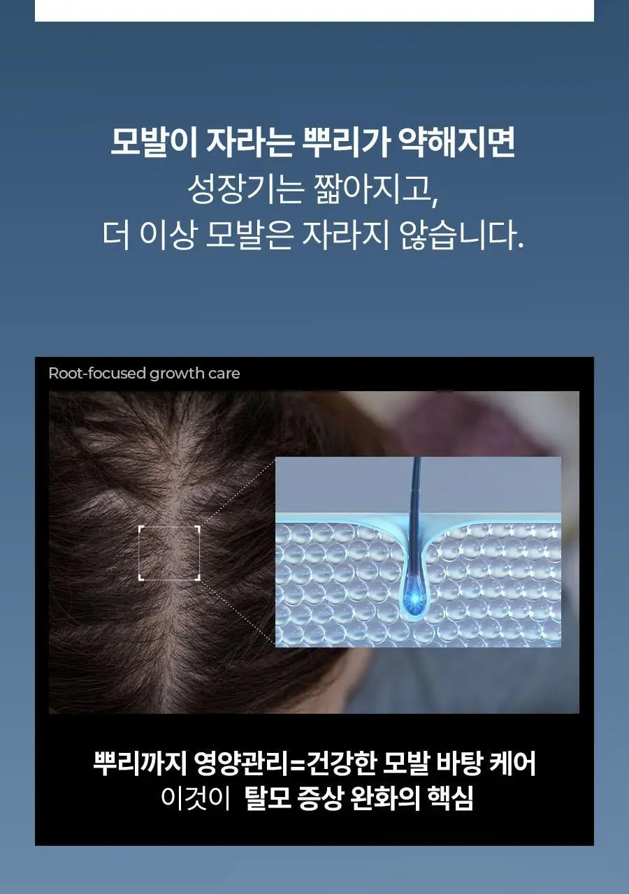 [2주완성탈모앰플] 에이페 스칼프부스팅 앰플 (대용량 두피앰플) 150ml 상세페이지 17